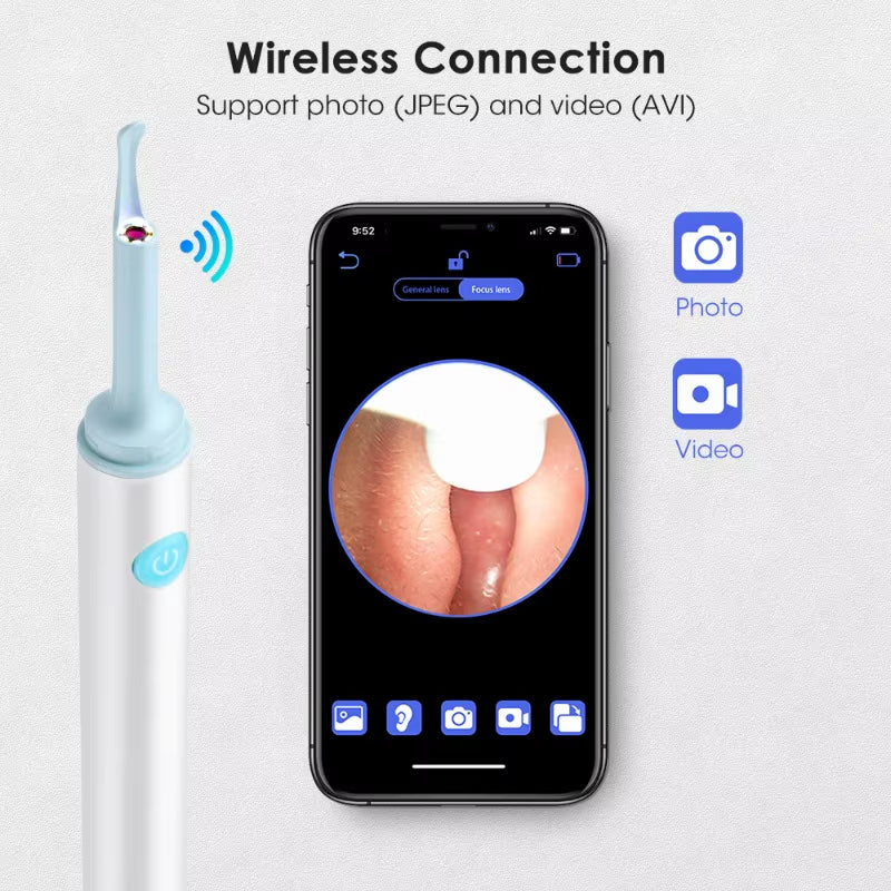 Wireless Visual Silicone Ear Spoon Safe Endoscope Earpick 5MP Camera Ear Wax Remover Luminous Otoscope 4Mm Ear Cleaning Tools